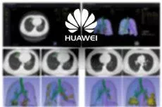 umělá inteligence Huawei koronavirus