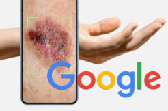 google rakovina kůže