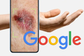 google rakovina kůže
