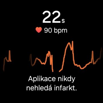 Galaxy Watch Ultra -měření EKG